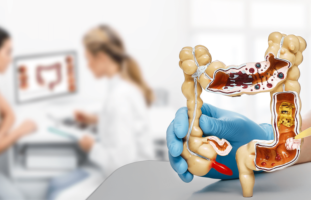 A Guide to Colon Cancer Staging and Treatment Options